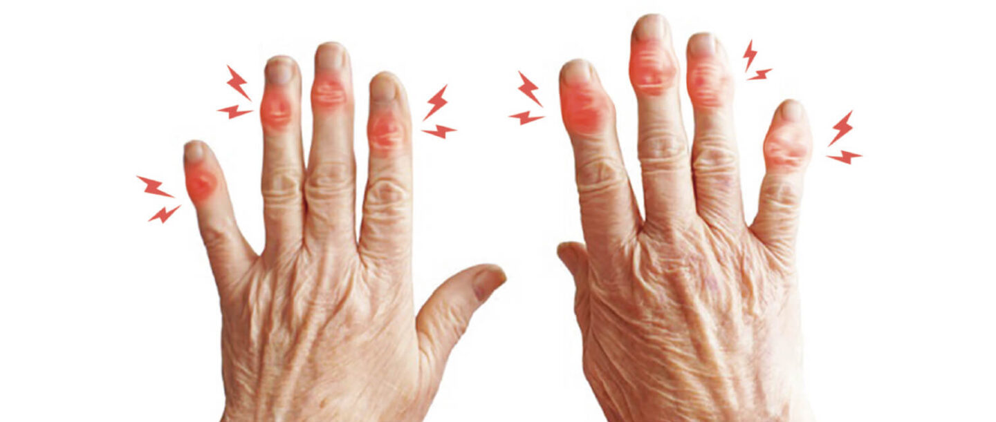 モヤモヤ血管への動注治療について