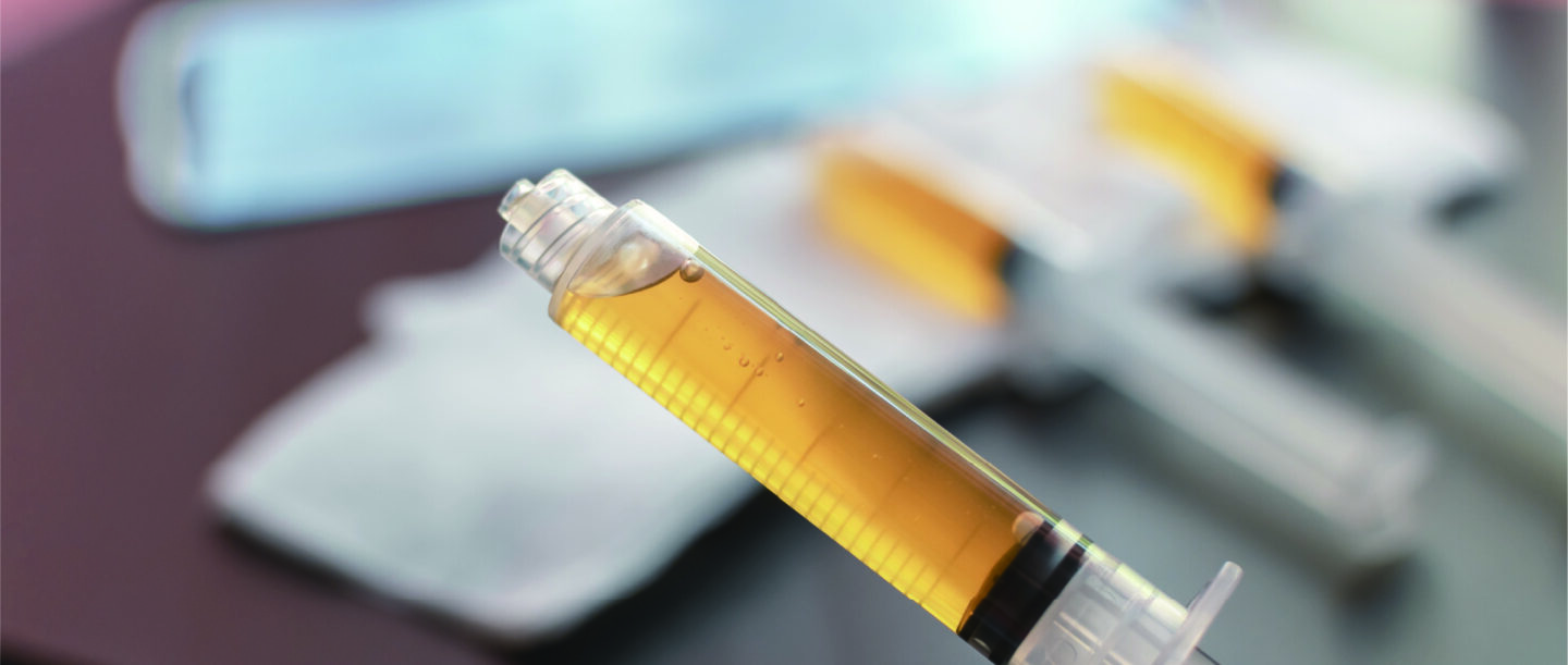 PRP（多血小板血漿）治療